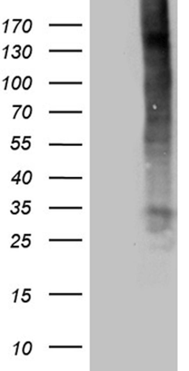 TNFSF4 Antibody in Western Blot (WB)
