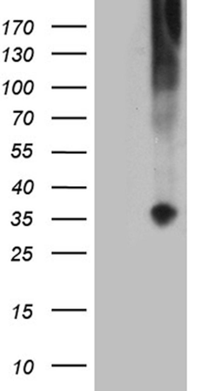 TNFSF4 Antibody in Western Blot (WB)