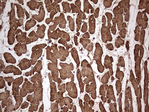 TNNC1 Antibody in Immunohistochemistry (Paraffin) (IHC (P))