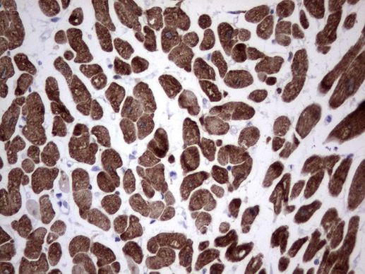 TNNC1 Antibody in Immunohistochemistry (Paraffin) (IHC (P))