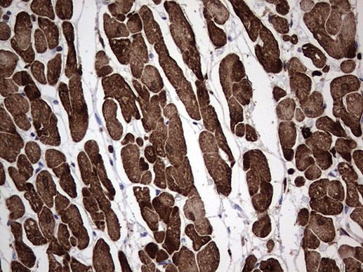 TNNC1 Antibody in Immunohistochemistry (Paraffin) (IHC (P))