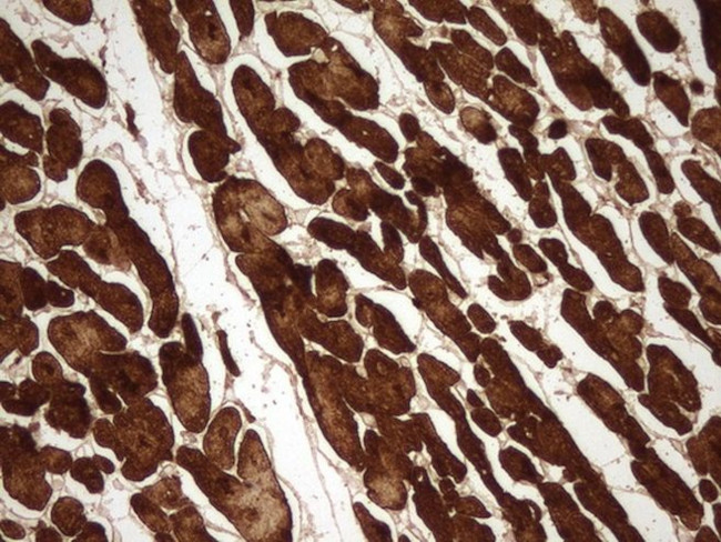 TNNC1 Antibody in Immunohistochemistry (Paraffin) (IHC (P))