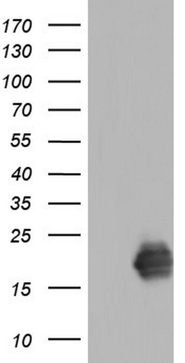 TNNC1 Antibody in Western Blot (WB)