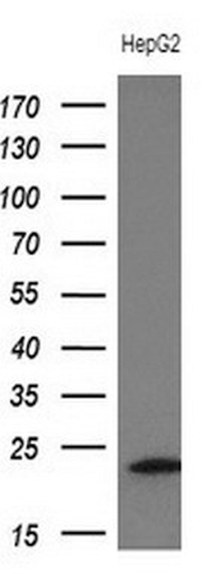 TNNI2 Antibody in Western Blot (WB)