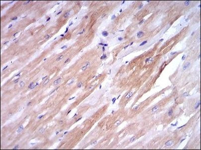 TNNI2 Antibody in Immunohistochemistry (Paraffin) (IHC (P))