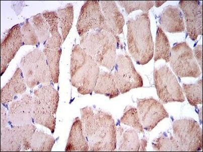 TNNI2 Antibody in Immunohistochemistry (Paraffin) (IHC (P))