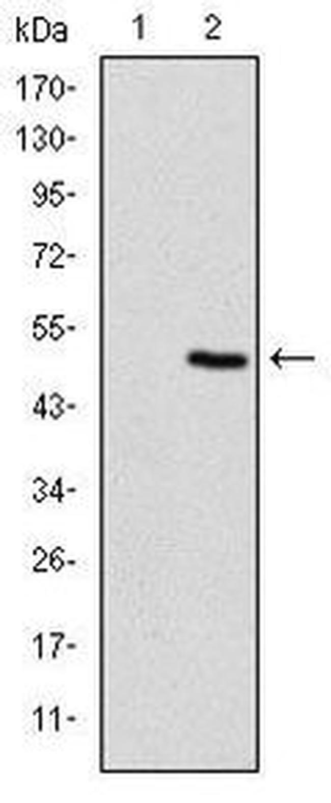 TNNI2 Antibody in Western Blot (WB)