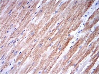 TNNI2 Antibody in Immunohistochemistry (Paraffin) (IHC (P))