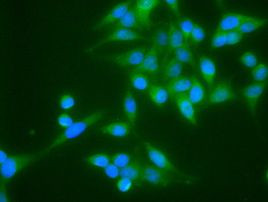 TNNI3 Antibody in Immunocytochemistry (ICC/IF)