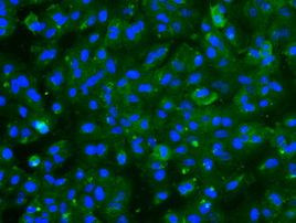 TNNI3 Antibody in Immunocytochemistry (ICC/IF)