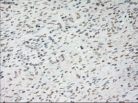 TNNI3 Antibody in Immunohistochemistry (Paraffin) (IHC (P))