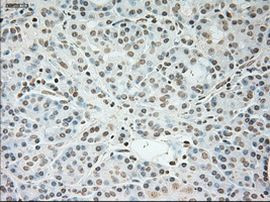 TNNI3 Antibody in Immunohistochemistry (Paraffin) (IHC (P))