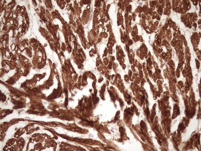 TNNI3 Antibody in Immunohistochemistry (Paraffin) (IHC (P))