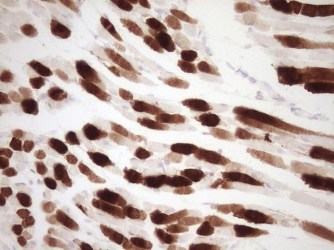 TNNI3 Antibody in Immunohistochemistry (Paraffin) (IHC (P))