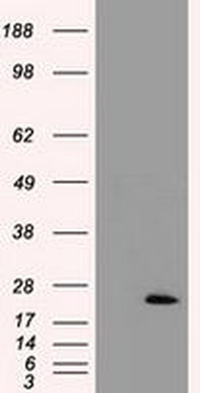 TNNI3 Antibody in Western Blot (WB)