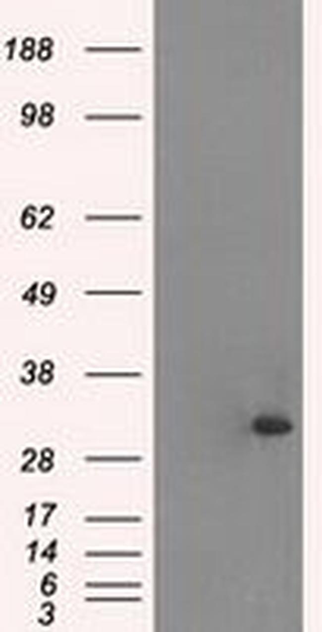 TNNI3 Antibody in Western Blot (WB)