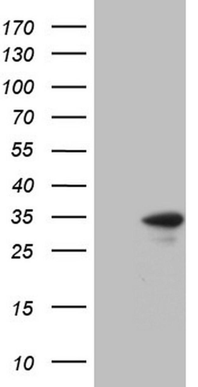 TNNI3 Antibody in Western Blot (WB)