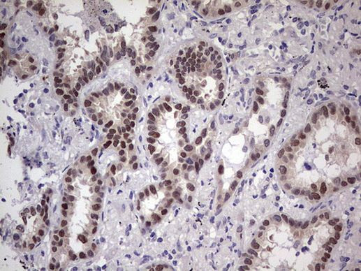 TNNT2 Antibody in Immunohistochemistry (Paraffin) (IHC (P))