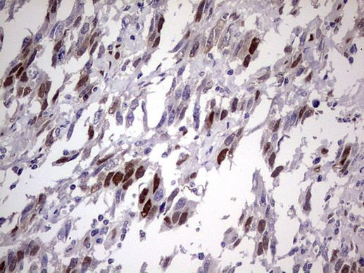 TNNT2 Antibody in Immunohistochemistry (Paraffin) (IHC (P))