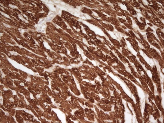 TNNT2 Antibody in Immunohistochemistry (Paraffin) (IHC (P))