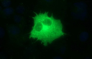 TOLLIP Antibody in Immunocytochemistry (ICC/IF)