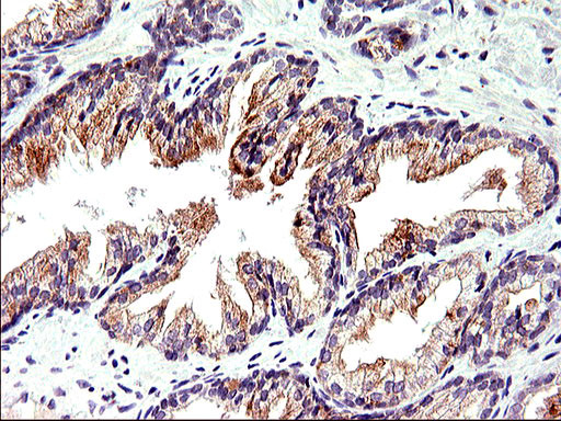 TOLLIP Antibody in Immunohistochemistry (Paraffin) (IHC (P))