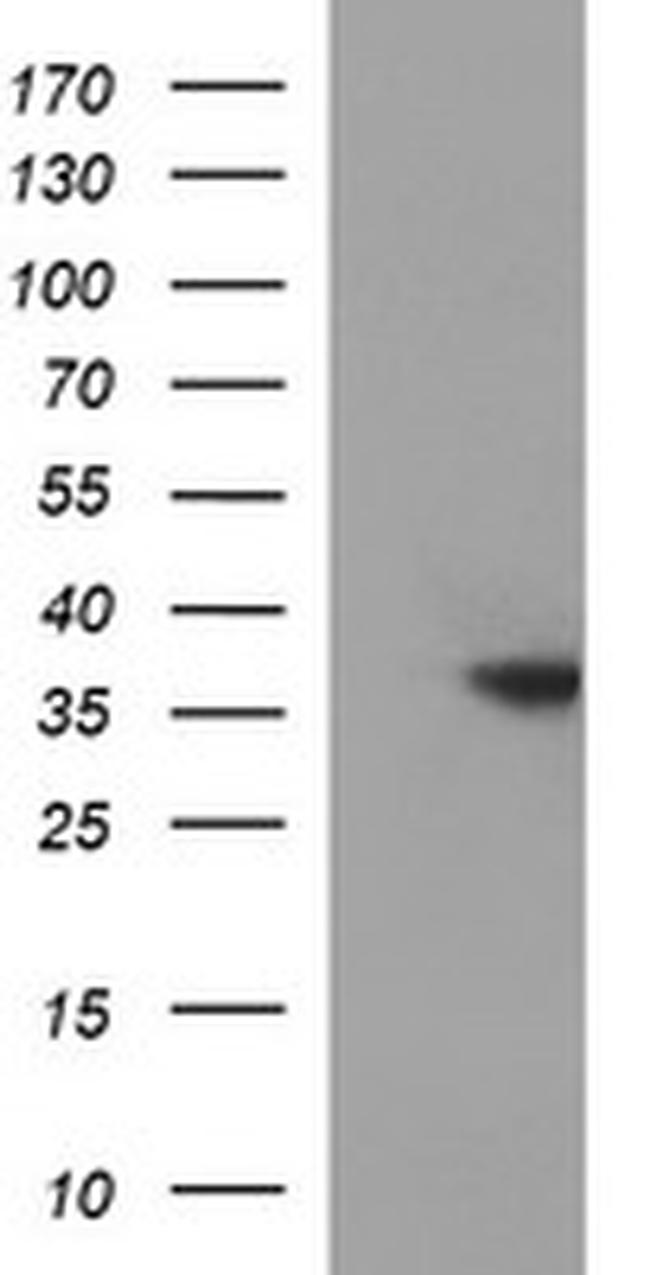 TOLLIP Antibody in Western Blot (WB)