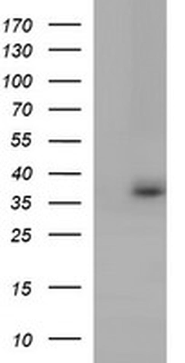 TOLLIP Antibody in Western Blot (WB)