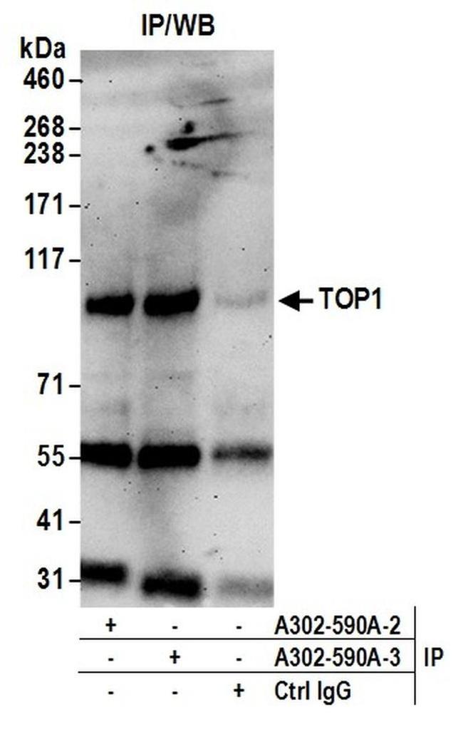 TOP1 Antibody in Western Blot (WB)