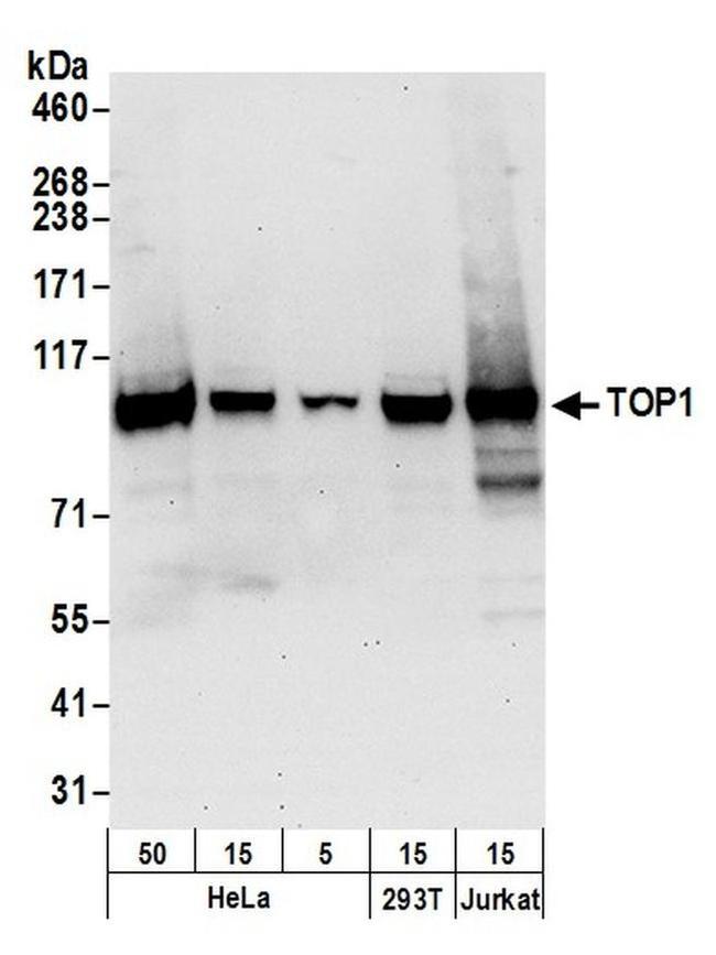 TOP1 Antibody in Western Blot (WB)