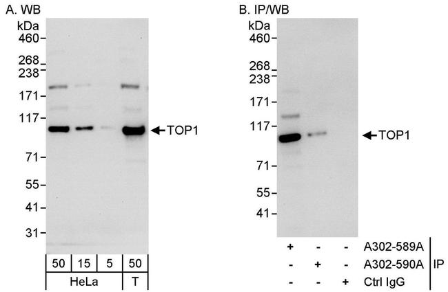 TOP1 Antibody in Western Blot (WB)