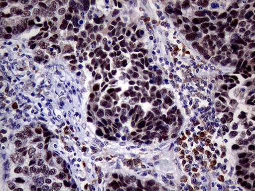 TOP1 Antibody in Immunohistochemistry (Paraffin) (IHC (P))