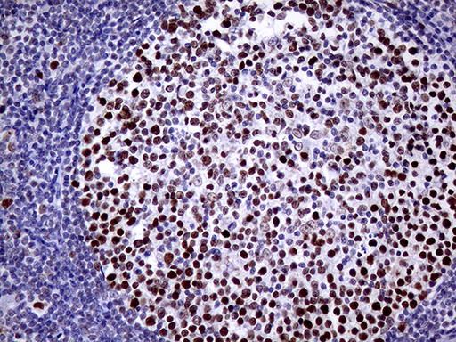 TOP1 Antibody in Immunohistochemistry (Paraffin) (IHC (P))