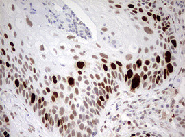 TOP2A Antibody in Immunohistochemistry (Paraffin) (IHC (P))