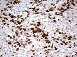 TOP2A Antibody in Immunohistochemistry (Paraffin) (IHC (P))