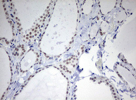 TOP2A Antibody in Immunohistochemistry (Paraffin) (IHC (P))