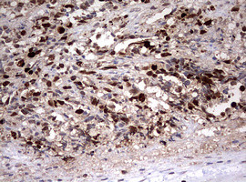 TOP2A Antibody in Immunohistochemistry (Paraffin) (IHC (P))