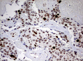 TOP2A Antibody in Immunohistochemistry (Paraffin) (IHC (P))