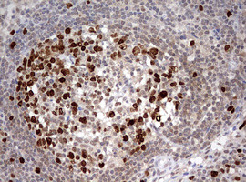 TOP2A Antibody in Immunohistochemistry (Paraffin) (IHC (P))