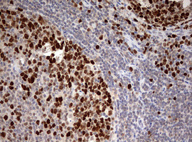 TOP2A Antibody in Immunohistochemistry (Paraffin) (IHC (P))