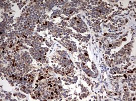 TOP2A Antibody in Immunohistochemistry (Paraffin) (IHC (P))