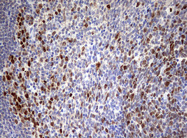 TOP2A Antibody in Immunohistochemistry (Paraffin) (IHC (P))