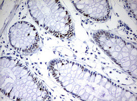 TOP2A Antibody in Immunohistochemistry (Paraffin) (IHC (P))