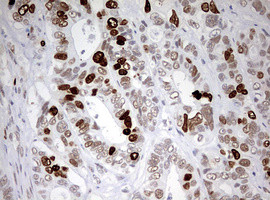 TOP2A Antibody in Immunohistochemistry (Paraffin) (IHC (P))