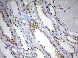 TOP2A Antibody in Immunohistochemistry (Paraffin) (IHC (P))