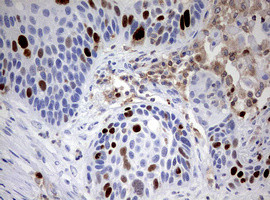 TOP2A Antibody in Immunohistochemistry (Paraffin) (IHC (P))