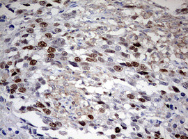 TOP2A Antibody in Immunohistochemistry (Paraffin) (IHC (P))