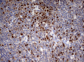 TOP2A Antibody in Immunohistochemistry (Paraffin) (IHC (P))