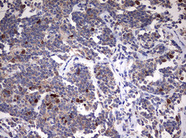 TOP2A Antibody in Immunohistochemistry (Paraffin) (IHC (P))