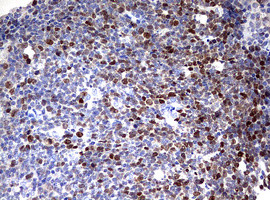 TOP2A Antibody in Immunohistochemistry (Paraffin) (IHC (P))